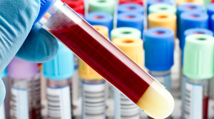 ДИАГНОСТИКА - Лечение апноэ сна (остановок дыхания во сне) и храпа ...